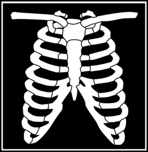 chest x-ray